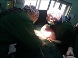خارج کردن موفق کیست بزرگ  10 کیلویی از شکم خانم 37 ساله در اتاق عمل بیمارستان شهید دکتر بهشتی مراغه